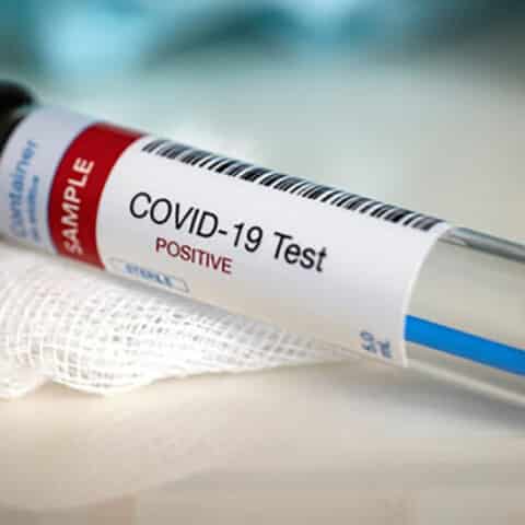 Covid-19 (12.04.'21) - Κυκλάδες: Καμια μόλυνση/κρούσμα μετά από πολύ καιρό - Επικράτεια: 1.606 νέες μολύνσεις/κρούσματα, 781 διασωληνωμένοι, 76 ασθενείς κατέληξαν στις ΜΕΘ