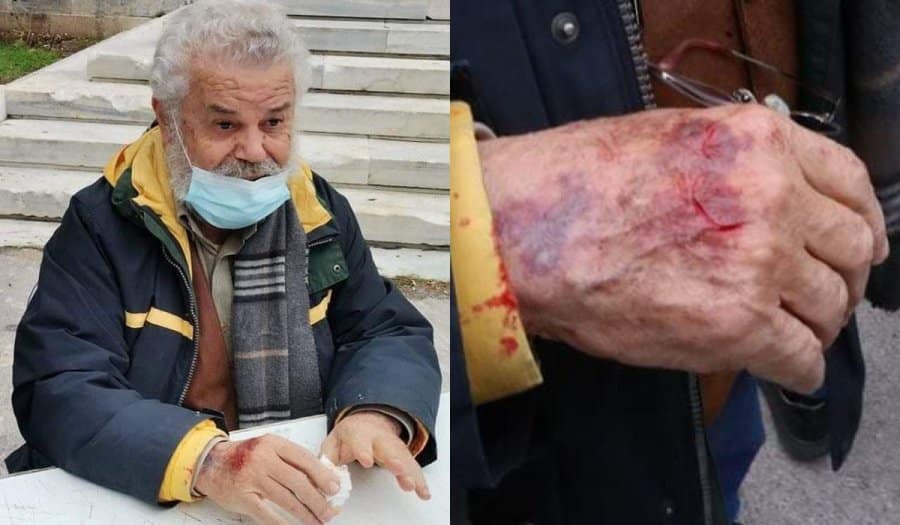 Πολυτεχνείο: Τραυματίστηκε ο Νίκος Μανιός – Το tweet του Παππά